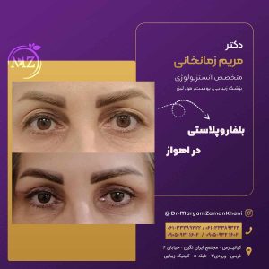 بلفاروپلاستی در اهواز