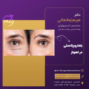 بلفاروپلاستی در اهواز