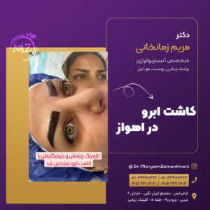 کاشت ابرو در اهواز